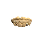 Single Gold Cap (10-18k) w/ Window options.