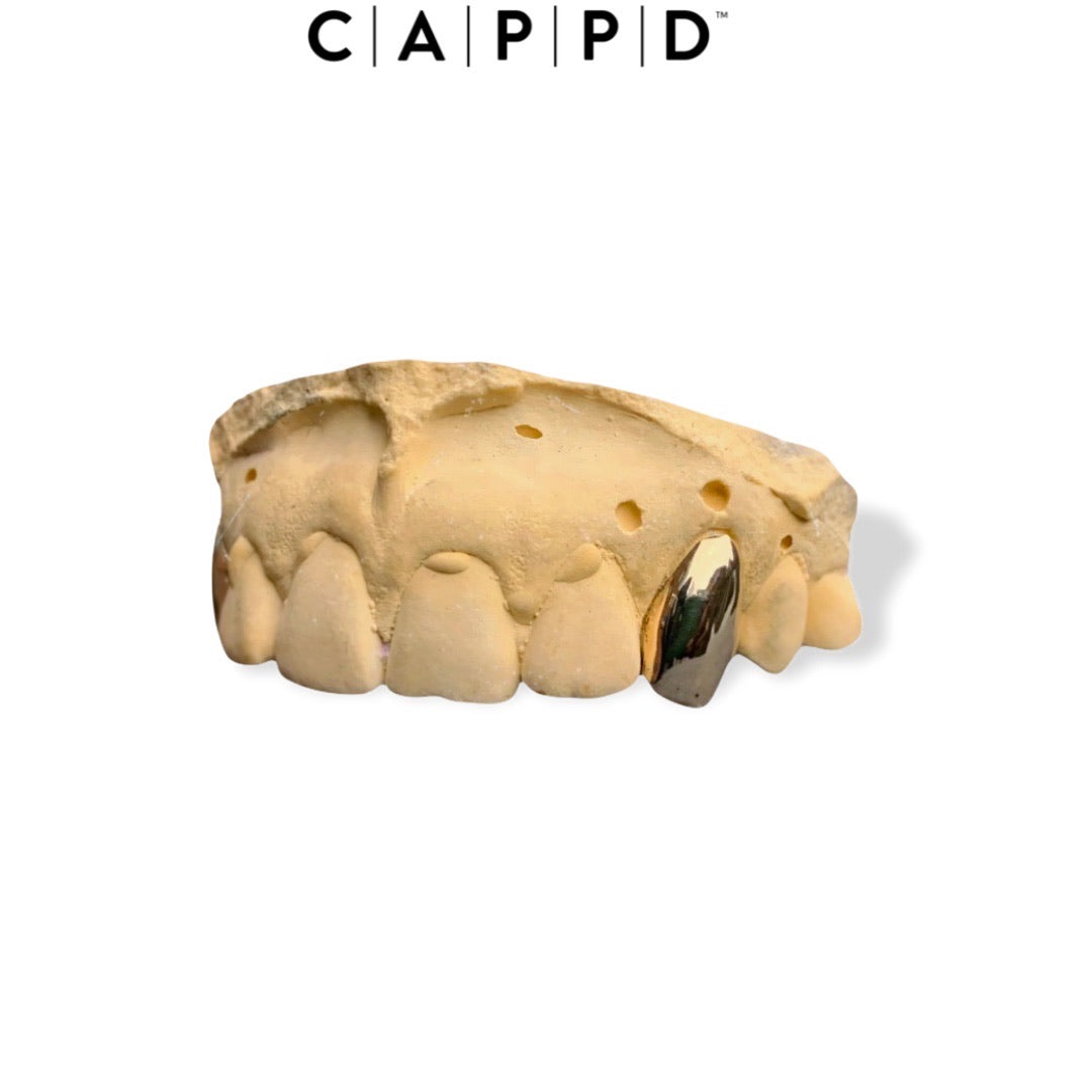 single gold tooth cap