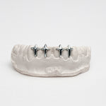 Nocta Starcross Gap Filler Grillz – 2-4 Teeth | High-Polish Silver/10k Gold