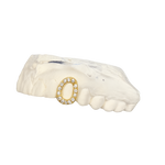 Gold Moissanite Set window - Diamond Cap Grillz