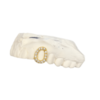 Gold Moissanite Set window - Diamond Cap Grillz