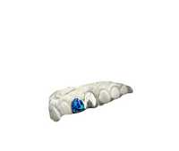 A single silver opal cap with a blue lab-made opal embedded on one tooth, against a white background.