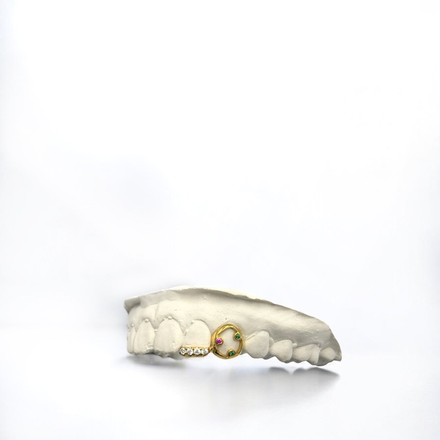 Te Trois - Twin Diamond Grillz - 2 Teeth (Double Cap) 10, 14, 18k Gold