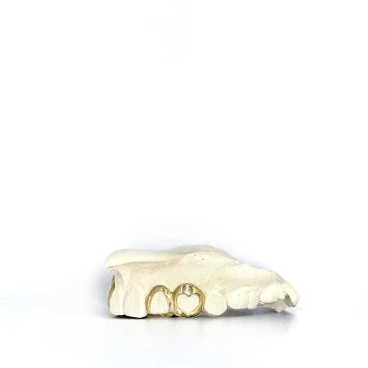 Loveit - Heart & Open Face Window - 2 Teeth (Double Cap Grillz) 10, 14, 18k Gold