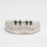Nocta Starcross Gap Filler Grillz – 2-4 Teeth | High-Polish Silver/10k Gold