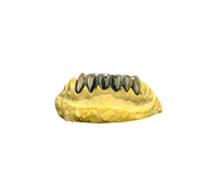 silver six-tooth grillz with a Yellow-colored stone mould, displayed against a white background with the brand logo 'CAPPD' at the top.