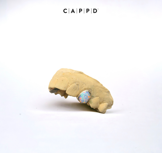 Single Gold Opal Cap (10-18k)