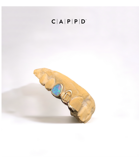 Tri Cap Opal Grillz (10-18k Gold)