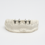 Nocta Starcross Gap Filler Grillz – 2-4 Teeth | High-Polish Silver/10k Gold