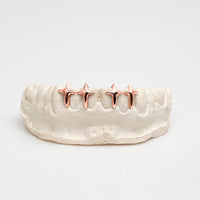 Nocta Starcross Gap Filler Grillz – 2-4 Teeth | High-Polish Silver/10k Gold