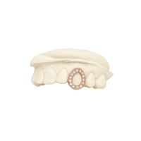 Gold Vermeil Moissanite Set window - Diamond Cap Grillz