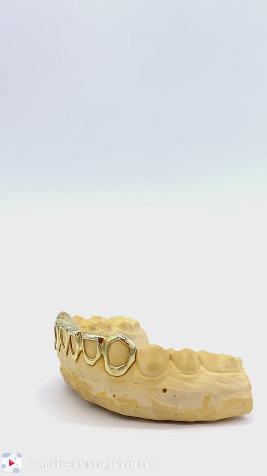 18k Gold vermeil 6ixSet (6 Teeth Pcs)
