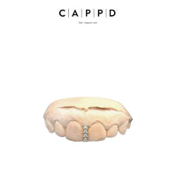 Diamond Cap Grillz - Diamond ( SI, VS, VVS) Set Gap Filler.