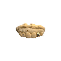 Single Gold Cap (10-18k) w/ Window options.