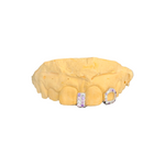 Diamond Cap Grillz - CZ Set Gap Filler.
