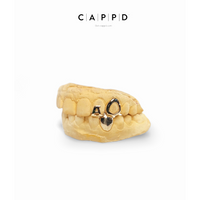 Luxury cap grillz-  Letter Cap, 10-18k Solid gold / Silver.