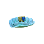 Enamel Grillz - Enamel Window (Silver/10-18k Gold).