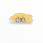 Diamond grillz -Diamond Set Cap 'n' Strip 10-18k gold SI-VS.